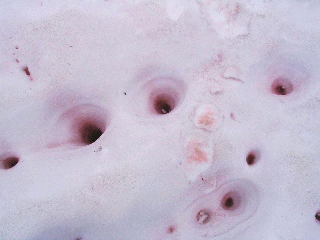 Watermelon Snow